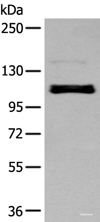 Western blot analysis of A549 cell  using ZNF281 Polyclonal Antibody at dilution of 1:250