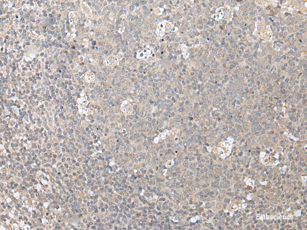 Immunohistochemistry of paraffin-embedded Human tonsil tissue  using ZFYVE1 Polyclonal Antibody at dilution of 1:40(×200)