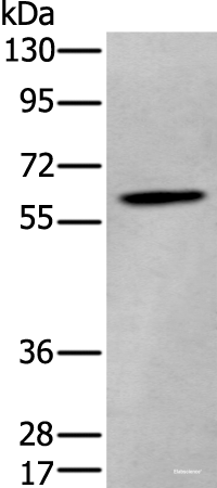 Western blot analysis of Human cerebrum tissue lysate  using ZKSCAN1 Polyclonal Antibody at dilution of 1:400