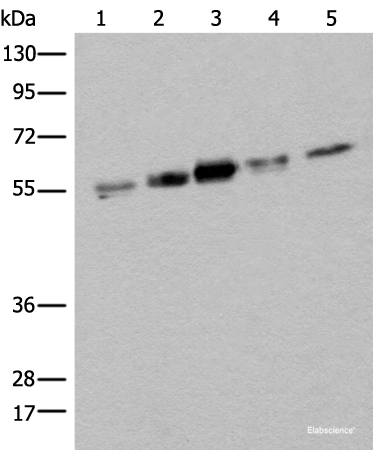 Western blot analysis of Hela HEPG2 231 A431 and Jurkat cell lysates  using ZPR1 Polyclonal Antibody at dilution of 1:400