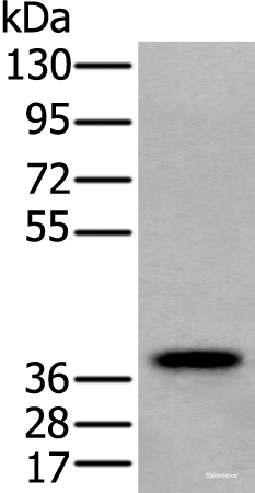Western blot analysis of Human testis tissue lysate  using ZPBP Polyclonal Antibody at dilution of 1:250