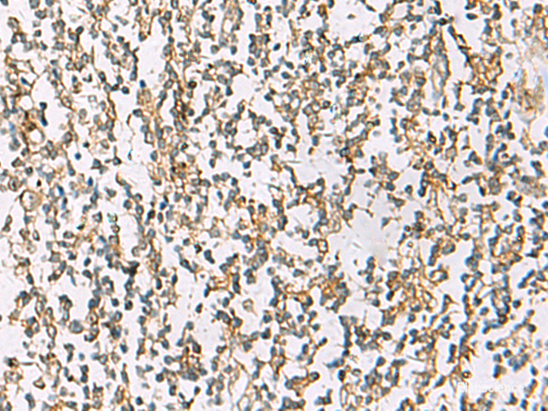 Immunohistochemistry of paraffin-embedded Human tonsil tissue  using ZPBP2 Polyclonal Antibody at dilution of 1:80(×200)
