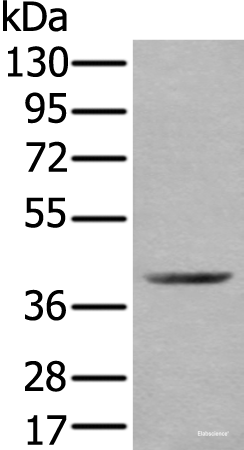 Western blot analysis of Mouse kidney tissue lysate  using WDFY2 Polyclonal Antibody at dilution of 1:350