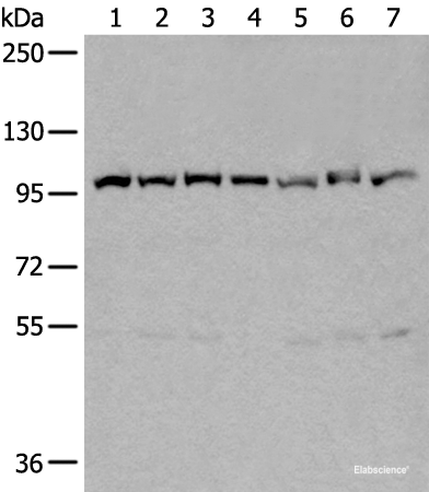 Western blot analysis of 231 Hela A549 A431 HEPG2 Jurkat and K562 cell lysates  using VCP Polyclonal Antibody at dilution of 1:400