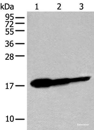 Western blot analysis of Human fetal brain tissue HT-29 cell and Jurkat cell lysates  using UBE2V1 Polyclonal Antibody at dilution of 1:250