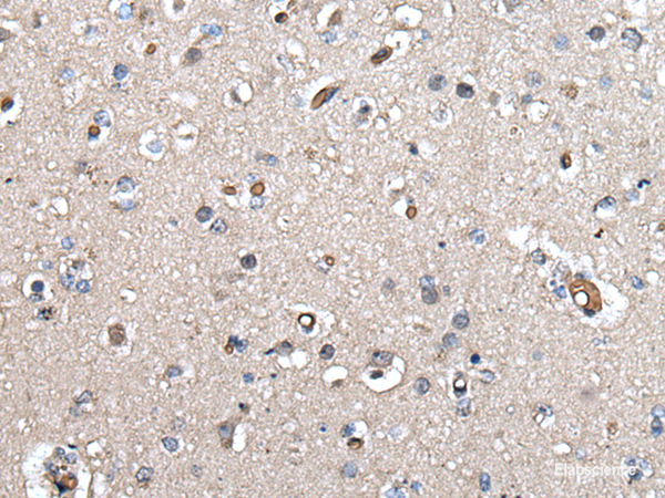 Immunohistochemistry of paraffin-embedded Human brain tissue  using UMPS Polyclonal Antibody at dilution of 1:40(×200)