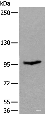 Western blot analysis of Mouse skeletal muscle tissue lysate  using UNC45B Polyclonal Antibody at dilution of 1:600