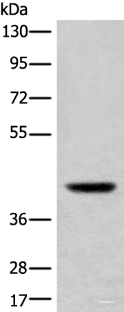 Western blot analysis of Mouse liver tissue lysate  using USP12 Polyclonal Antibody at dilution of 1:700