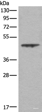 Western blot analysis of A431 cell lysate  using ASS1 Polyclonal Antibody at dilution of 1:350