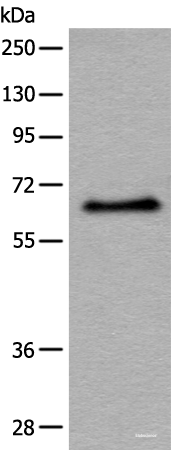Western blot analysis of Hela cell lysate  using ATF7 Polyclonal Antibody at dilution of 1:500