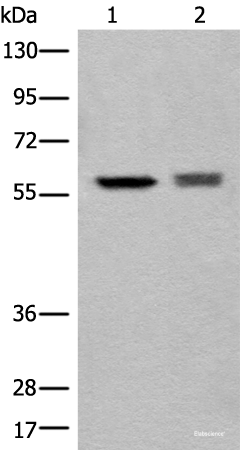 Western blot analysis of EPG2 and Jurkat cell lysates  using ATL3 Polyclonal Antibody at dilution of 1:800