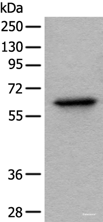 Western blot analysis of Hela cell lysate  using BAIAP2L1 Polyclonal Antibody at dilution of 1:1000