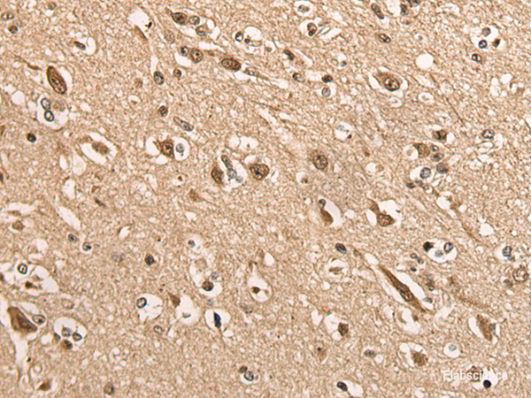 Immunohistochemistry of paraffin-embedded Human brain tissue  using BATF Polyclonal Antibody at dilution of 1:45(×200)