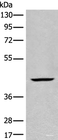 Western blot analysis of Human kidney tissue lysate  using BBOX1 Polyclonal Antibody at dilution of 1:650