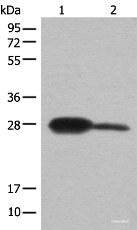 Western blot analysis of Mouse kidney tissue and A172 cell lysates  using BDH2 Polyclonal Antibody at dilution of 1:600