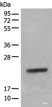 Western blot analysis of Mouse eye tissue lysate  using CRYGS Polyclonal Antibody at dilution of 1:800