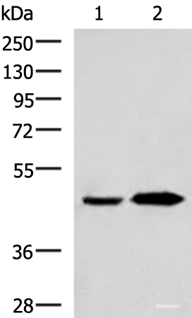 Western blot analysis of Human fetal liver tissue and Human liver tissue lysates  using BHMT2 Polyclonal Antibody at dilution of 1:800