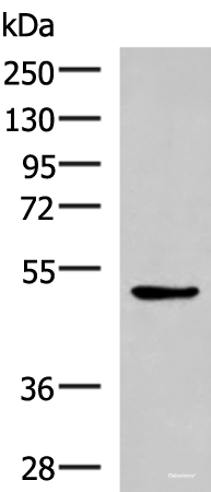 Western blot analysis of LOVO cell lysate  using BLNK Polyclonal Antibody at dilution of 1:600