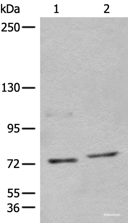 Western blot analysis of 562 and Jurkat cell lysates  using NCAPH Polyclonal Antibody at dilution of 1:450