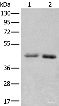 Western blot analysis of A549 and Hela cell lysates  using NADK2 Polyclonal Antibody at dilution of 1:1000