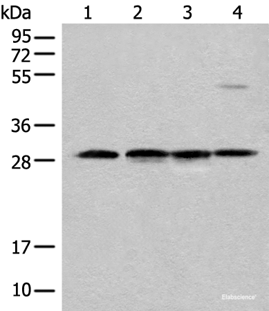 Western blot analysis of Human urinary bladder tissue Mouse heart tissue Mouse kidney tissue and RAW264.7 cell lysates  using CA7 Polyclonal Antibody at dilution of 1:500