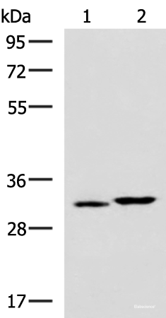 Western blot analysis of 293T cell lysates  using CBR3 Polyclonal Antibody at dilution of 1:800