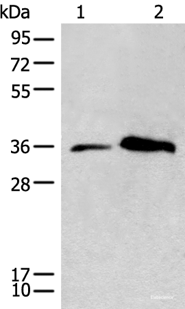 Western blot analysis of Human lymph gland tissue and Jurkat cell lysates  using CD86 Polyclonal Antibody at dilution of 1:450