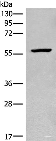 Western blot analysis of Mouse heart tissue lysate  using CDADC1 Polyclonal Antibody at dilution of 1:450