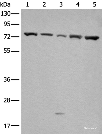 Western blot analysis of Hela and A431 cell Mouse brain tissue HT-29 and Jurkat cell lysates  using GARS Polyclonal Antibody at dilution of 1:540