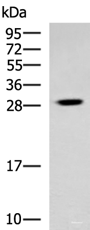 Western blot analysis of Human cerebrum tissue lysate  using TBCB Polyclonal Antibody at dilution of 1:800