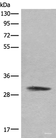 Western blot analysis of Hela cell lysate  using COMT Polyclonal Antibody at dilution of 1:450