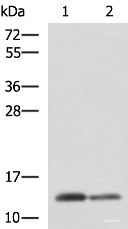 Western blot analysis of Human breast tissue and Human thyroid tissue lysates  using CRABP1 Polyclonal Antibody at dilution of 1:2000