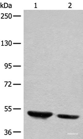 Western blot analysis of Human fetal brain tissue and mouse brain tissue lysates  using DENND1B Polyclonal Antibody at dilution of 1:400