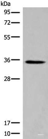 Western blot analysis of Rat kidney tissue lysate  using ITM2B Polyclonal Antibody at dilution of 1:500