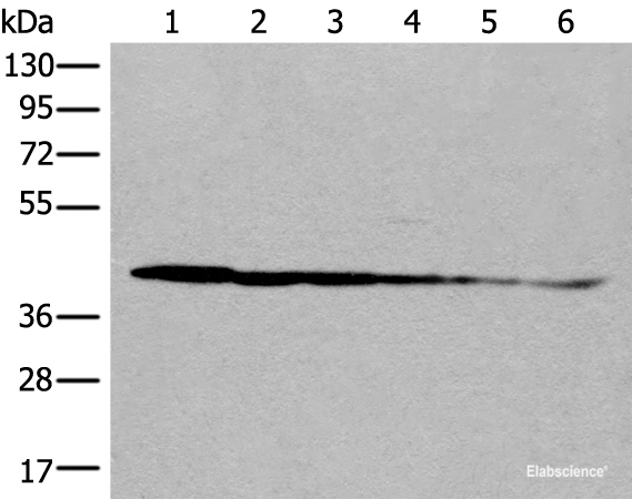 Western blot analysis of Rat brain tissue Human cerebrum tissue Human fetal brain tissue Hela cell Human breast cancer tissue Jurkat cell lysates  using PITPNB Polyclonal Antibody at dilution of 1:500