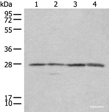 Western blot analysis of 293T Jurkat and 231 cell lysates  using COMT Polyclonal Antibody at dilution of 1:350