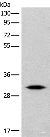 Western blot analysis of Human cerebrum tissue lysate  using IMPA1 Polyclonal Antibody at dilution of 1:360