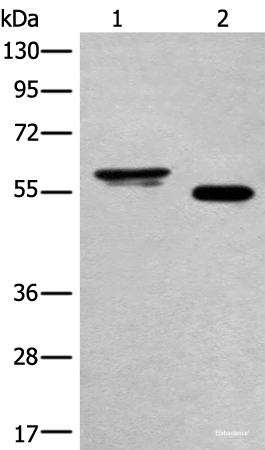 Western blot analysis of Human cervical cancer tissue and A549 cell lysates  using HAS3 Polyclonal Antibody at dilution of 1:400
