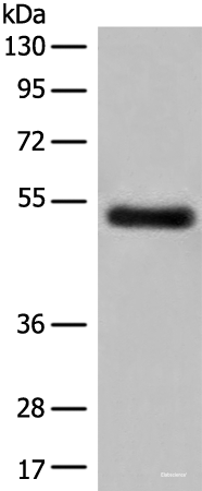 Western blot analysis of Human breast cancer tissue lysate  using GK5 Polyclonal Antibody at dilution of 1:500