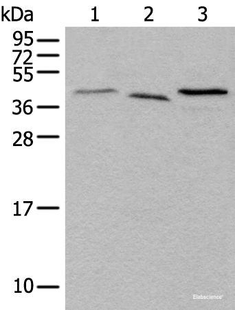 Western blot analysis of Mouse brain tissue Hela and HEPG2 cell lysates  using UBXN1 Polyclonal Antibody at dilution of 1:500