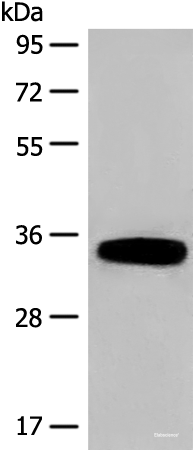 Western blot analysis of Human fetal liver tissue lysate  using DHRS1 Polyclonal Antibody at dilution of 1:400