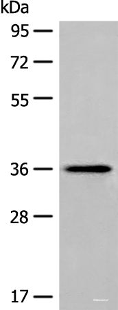 Western blot analysis of Human liver tissue lysate  using MLST8 Polyclonal Antibody at dilution of 1:400