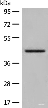 Western blot analysis of Human kidney tissue lysate  using DHRS7 Polyclonal Antibody at dilution of 1:400