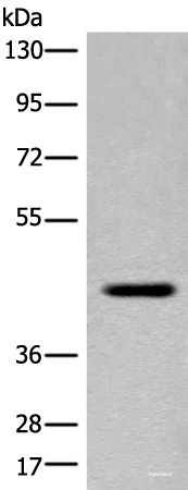Western blot analysis of Human placenta tissue lysate  using FAM105A Polyclonal Antibody at dilution of 1:400