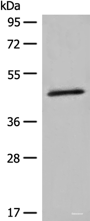Western blot analysis of K562 cell lysate  using HMBS Polyclonal Antibody at dilution of 1:450