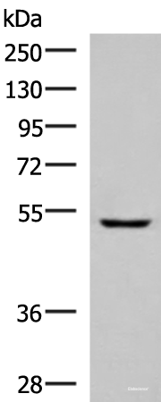 Western blot analysis of Human fetal liver tissue lysate  using PISD Polyclonal Antibody at dilution of 1:600