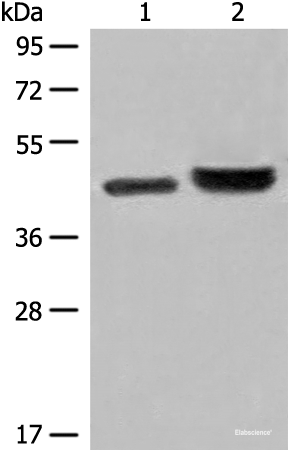 Western blot analysis of 231 cell and Human fetal liver tissue lysates  using INPP1 Polyclonal Antibody at dilution of 1:500
