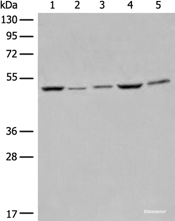 Western blot analysis of Raji Hela A549 HEPG2 and 231 cell lysates  using EIF4A3 Polyclonal Antibody at dilution of 1:500