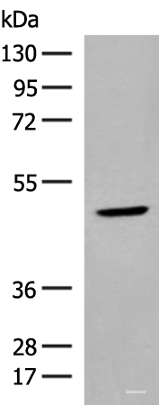 Western blot analysis of Human thyroid tissue lysate  using ZBTB8A Polyclonal Antibody at dilution of 1:350
