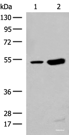 Western blot analysis of Human left thymus tissue and Mouse kidney tissue lysates  using ZBTB43 Polyclonal Antibody at dilution of 1:250